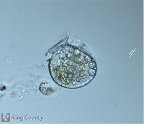 Photo of Dinophysis parva